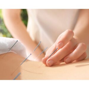 Acupuncture Training