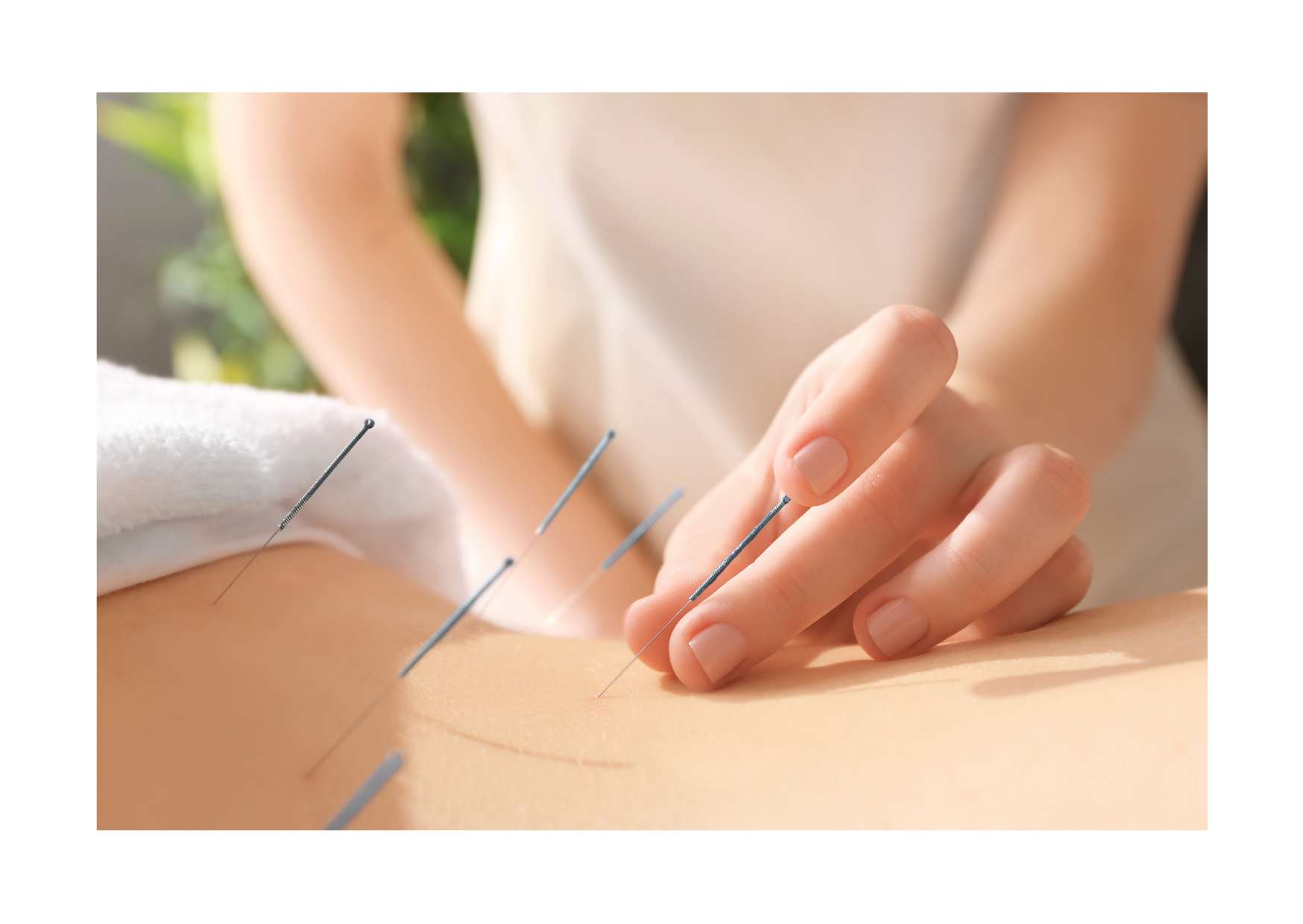 Acupuncture Training